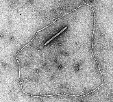 Rad51-DNAの電子顕微鏡写真