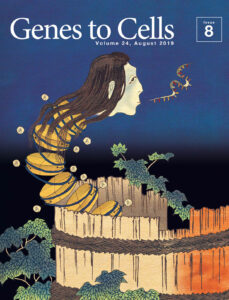 恐怖！アセチル化ヒストンろくろ首